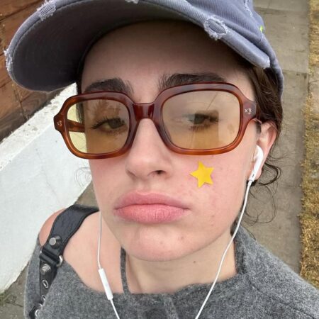 O que o estresse pode causar na pele? Acne e envelhecimento precoce estão na lista